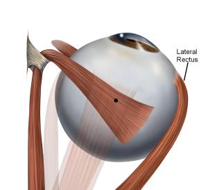 By Patrick J. Lynch, medical illustrator - Wikipedia Lateral Rectus page, CC BY 2.5, Link